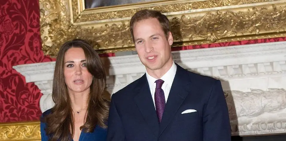 does prince william have yellow teeth